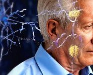 Alzheimer