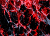 Scoperta proteina che innesca crescita dei tumori