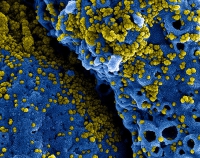Virus Cina, il cammino dei coronavirus