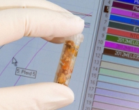 I super antibiotici riducono la mortalità dal 50% al 10%